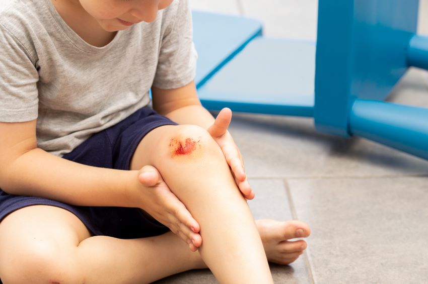 Photo shows a child holding their knee which has a scrape.